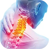 Профилактика остеохондроза