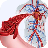 Нарушение циркуляции крови